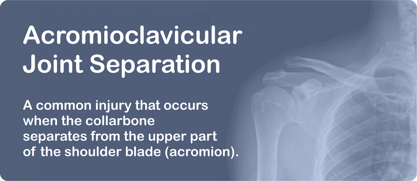 acj-separation-banner